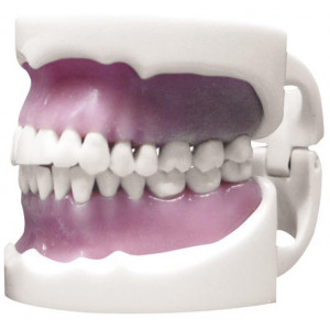 MODELLO SU OCCLUSORE DENTI...
